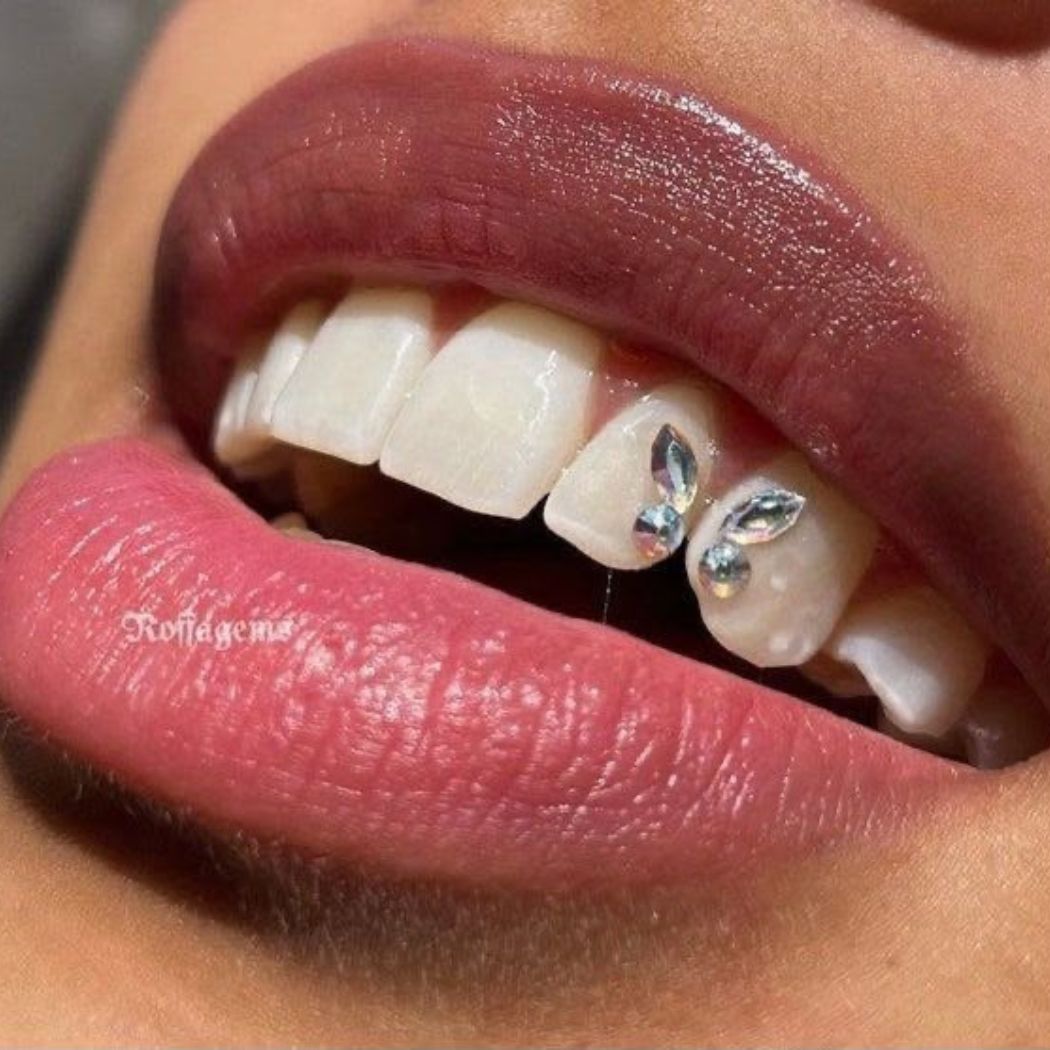 4 (2)
